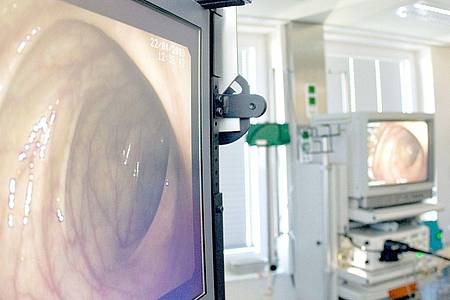 Blick in den Darm: Bei einer Darmspiegelung wird ein Schlauch mit einer Kamera über den After in den Darm eingeführt.